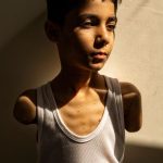 Portrait of a wounded Palestinian boy wins Press Photo of the Year