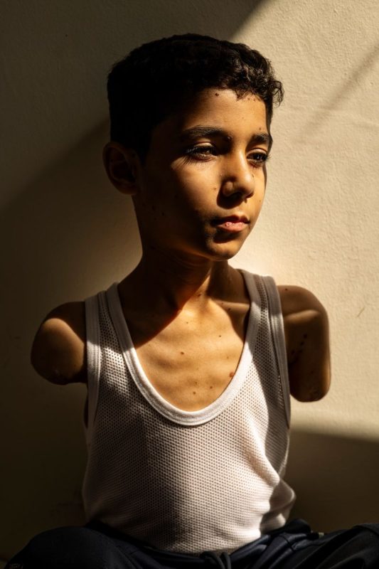 Portrait of a wounded Palestinian boy wins Press Photo of the Year